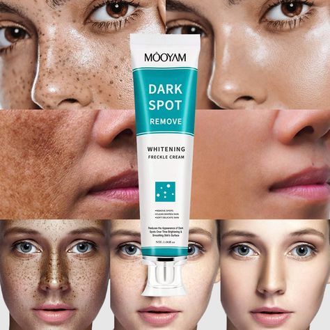 Private Label Deep Whitening Freckle Cream Wholesale Remove Melasma Dark Spots Melanin Brighten Face Skin Care Anti-Aging Cream https://m.alibaba.com/product/1600583919021/Private-Label-Deep-Whitening-Freckle-Cream.html?__sceneInfo={"cacheTime":"1800000","type":"appDetailShare"} Freckle Remover, Freckle Cream, Dark Spot Remover, Spot Remover, Dermatological Skin Care, Basic Skin Care Routine, Beauty Tips For Glowing Skin, Remove Dark Spots, Even Out Skin Tone