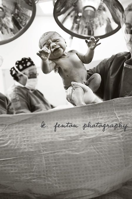 birth photography-birth Delivery Room Photos, Delivery Photography, Baby Hospital Pictures, Hospital Photos Newborn, Birth Pictures, Hospital Newborn, Foto Newborn, Hospital Photography, Hospital Pictures