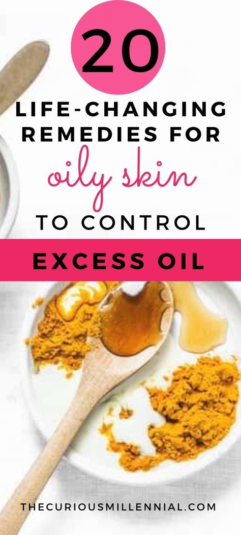 Oily Face Remedy, Remedies For Oily Skin, Face Remedies, Exposed Skin Care, Oily Skin Face, Oily Skin Remedy, Skin Care Home Remedies, Treating Acne, Lotion For Oily Skin