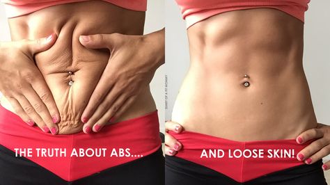 The Truth About Abs & Loose Skin After Pregnancy + Your Ab Questions Answered! Diary Of A Fit Mommy, Mommy Workout, Loose Skin, Ab Workouts, After Baby, Fitness Transformation, Body Fitness, Getting Fit, I Work Out