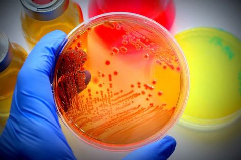 Microbiology culture market Home Pregnancy Test, Culture Media, Rutgers University, In Vitro Fertilization, Microbiology, Biotechnology, Life Science, Marketing Trends, Media Marketing