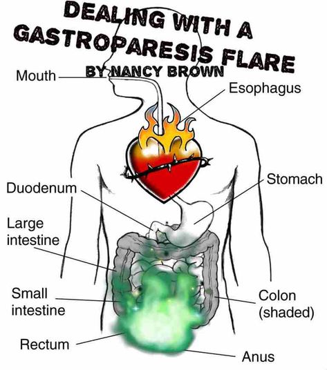 Gastric Problem, Gastrointestinal Disease, Reflux Symptoms, Stomach Issues, Ehlers Danlos, Ehlers Danlos Syndrome, Invisible Illness, Acid Reflux, Autoimmune Disease