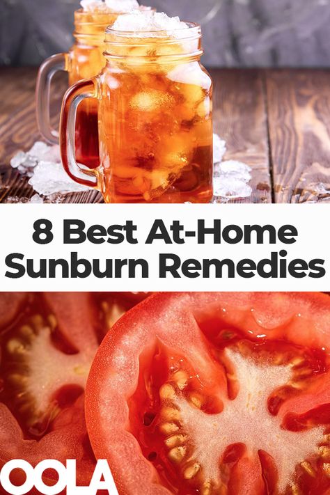 Sunburn Remedies: 8 of the Best At-Home Treatments - Oola.com Sunburn Home Remedies, Sore Gums Remedy, Best Remedy For Sunburn, Sunburn Remedies, Skin Natural Remedies, Healthier Choices, Home Health Remedies, Skin Lotion, Skin Remedies