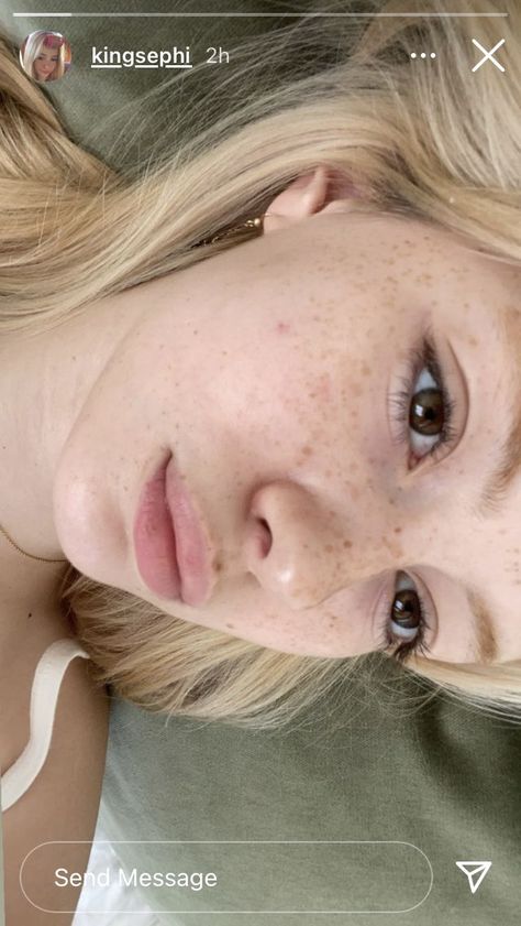 Blonde With Freckles, Fair Skin Makeup, Freckles Makeup, Freckles Girl, Cool Blonde Hair, Swag Makeup, Lily Rose, Fair Skin, Art Model