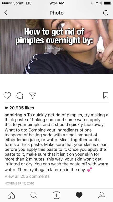 Pimple Hacks, Glow Tips, Text Pranks, Beauty Quiz, Pampering Routine, Pimples Overnight, Skincare 101, Hacks To Try, Face Tips