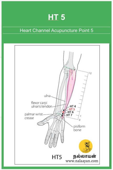 HT 5 Acupuncture Point Acupuncture Point, Acupuncture Points, Acupressure Points, Acupressure, Acupuncture