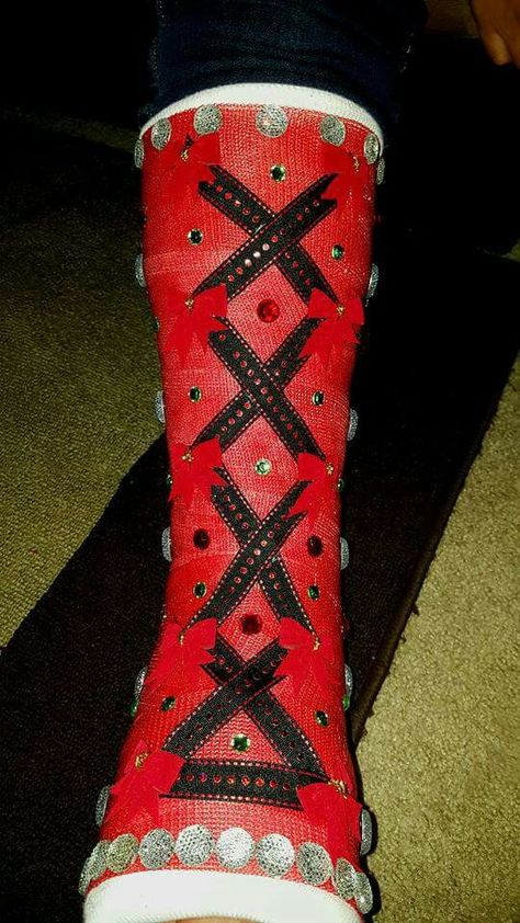 Decorated my leg cast for Christmas! Leg Cast Decorating Ideas, Cast Colors, Broken Foot, Leg Cast, Decorating Ideas Christmas, Cast Art, Marketing Ideas, Ideas Christmas, Decorating Ideas