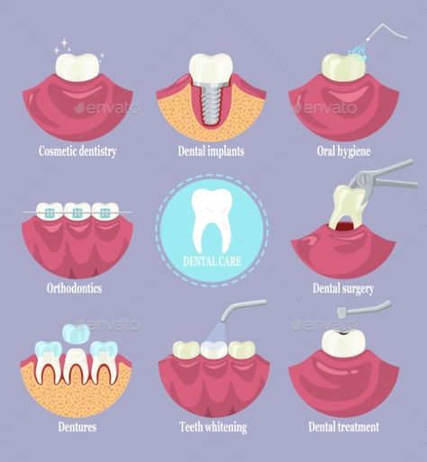 Orthodontics Teeth, Cosmetic Dentistry Procedures, Dental Posters, Dentist Clinic, Dental Art, General Dentistry, Dental Surgery, Clinic Design, Dentures