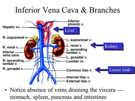 Inferior Vena Cava: Overview, Structure & Clinical Significance » How To Relief Central Venous Catheter, Medical Sonography, Diagnostic Medical Sonography, Arteries And Veins, Medical School Essentials, Lower Limb, Rad Tech, Human Body Systems, Medical Anatomy