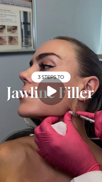 Dr. Kay Durairaj, MD, FACS on Instagram: "A strong, sculpted jawline can transform your entire profile—here’s how we achieve it in just 3 simple steps on gorgeous beauty guru @naventwins! 💛

Step 1: Create angle definition. Injecting filler at the back of the jaw helps to sharpen the angle and lift sagging skin, which instantly improves facial structure. 

Step 2: Address any asymmetries or irregularities. This is done by carefully sculpting along the jawline, ensuring a smooth, even appearance. 

Step 3: Create chin projection. Elongating and refining the chin area helps to balance the lower face and enhance overall symmetry. 

With these steps, the jawline will appear more defined and proportionate without looking overdone!
______________________________
💉: Come see me as a client! Ple Jaw Contouring Filler, Filler Face Lift, How To Sharpen Your Jawline, Jaw Filler Before And After, Face Balancing Fillers, Botox Jawline Before And After, Jawline Fillers Before And After, Chin Fillers Before After, Jaw Filler