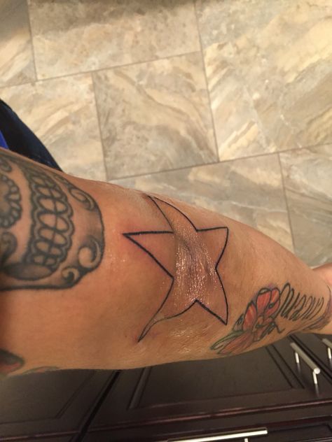 Star Around Elbow Tattoo, Star On Elbow Tattoo, Star On Knee Tattoo, Star Tattoo On Knee, Star Tattoo Knee, Star Tattoo Elbow, Elbows Tattoo, Heart Tattoo Elbow, Knee Star Tattoo