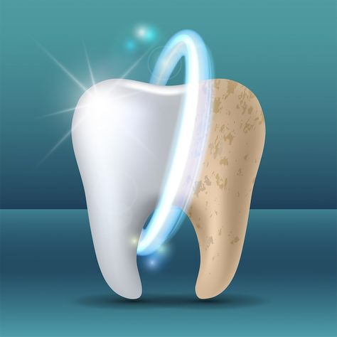 Clean and dirty tooth before and after w... | Premium Vector #Freepik #vector #medical #doctor #health #hospital Dental Advertising, Dental Images, Teeth Whitening Procedure, Dental Posters, Dentist Clinic, Kedokteran Gigi, Discolored Teeth, Dental Hospital, Loose Tooth