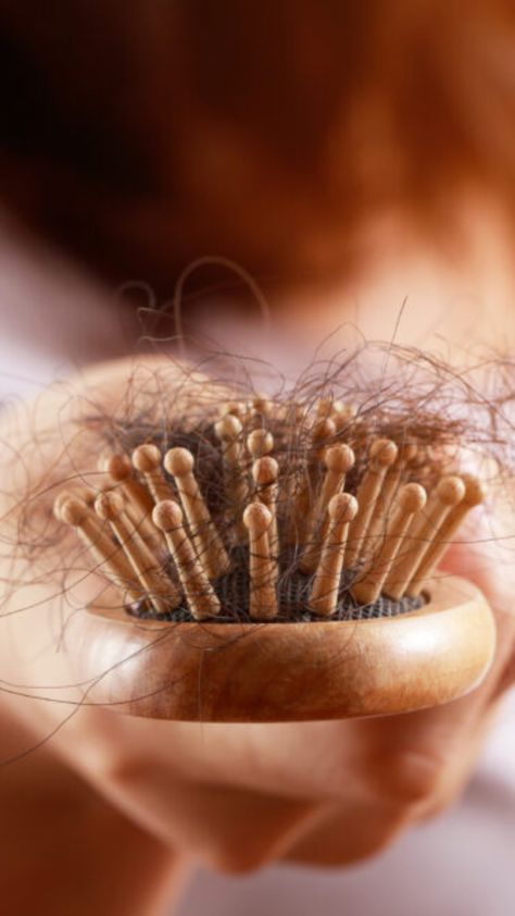 WHY IS MY HAIR FALLING OUT? 9 TRIGGERS OF HAIR LOSS IN WOMEN (AND WHAT TO DO ABOUT IT) | Click The Link To Find Out More https://channeling.com/blog/why-is-my-hair-falling-out-9-triggers-of-hair-loss-in-women-and-what-to-do-about-it/ #health #tips #self #hairloss #reasons #women #hair #explanation #channeling Hair Lossing Tips, Hair Lossing, Dove Hair Care, Hair Fall Remedy Home, Hair Is Falling Out, Soap Aesthetic, Hair Fall Remedy, Peroxide Uses, Healthy Looking Hair