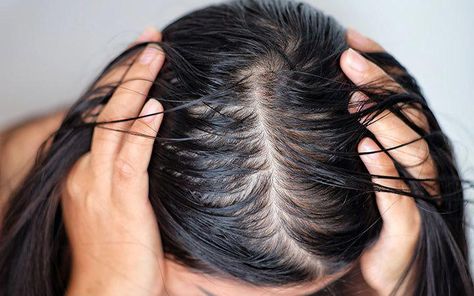 If you are looking for a solution for your oily scalp and dry hair ends, then this article is for you! Many factors like skin conditions, overwashing, usage of heating tools, wrong hair care products leads to combination hair type. Read on to find out the answers. Dry Ends Hair, Dry Hair Ends, Clean Shampoo, Oily Roots, Hair Scrub, Oily Scalp, Greasy Hair Hairstyles, Festival Hair, Moisturizing Shampoo