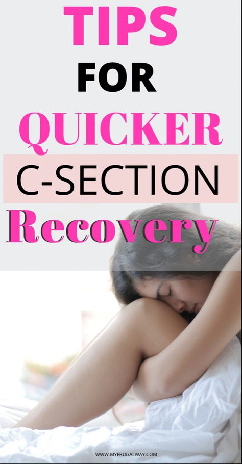 How to quickly recover from a c section, tips I wish I knew prior to my c section. C Section Tips, Postpartum Products, Recover Soon, Ease Your Mind, Best Healthy Diet, C Section Recovery, Abdominal Surgery, All About Pregnancy, Expecting A Baby