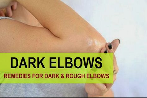 Rough Elbows, Dark Inner Thighs, Sunburn Peeling, Dry Elbows, Dark Elbows, Dark Underarms, Best Beauty Products, Perfect Skin Care Routine, Micro Mini Skirt