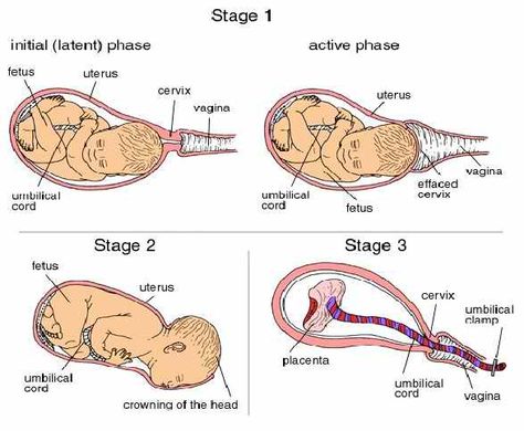 Stages of Labor... I love my job! I get to labor with my mommas! I don't just stand there ... I offer lots of support ... Pain relief , opening up the pelvis (getting baby to descend) I have tons if tricks up my sleeves!!! Midwifery Student, Student Midwife, Stages Of Labor, Induce Labor, Pregnancy Labor, Childbirth Education, Birth Doula, Natural Pregnancy, Birth Labor