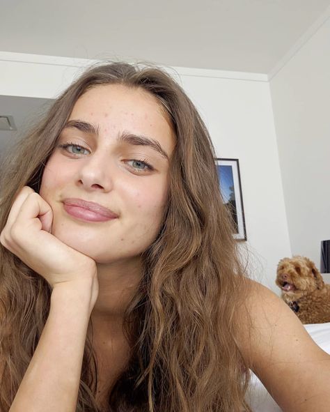 Models With Acne, Taylor Hill Instagram, Hills Pictures, Girl Almighty, Rosé Model, No Makeup Makeup, Taylor Marie Hill, Best Serum, Korean Skincare Routine