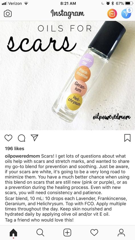 Scar Essential Oil Blend, Doterra Scar Blend, Scar Cream Essential Oils, Essential Oils For Scars After Surgery, Essential Oil For Scars, Essential Oil Roller Bottle Blends, Essential Oil Perfumes Recipes, Oils For Scars, Doterra Blends