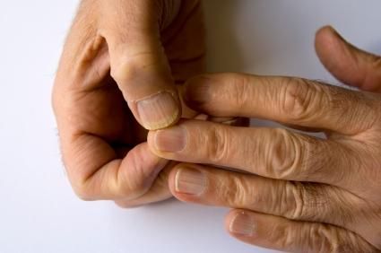 Fingernails can tell you something about your health ~ I guess mine are saying I need zinc. Already started taking it 2 weeks ago :) Fingernail Ridges, Nail Ridges, Nail Design Video, Pretty Nail Designs, Brittle Nails, Nail Health, Nails Desing, Health Wellbeing, Alternative Health