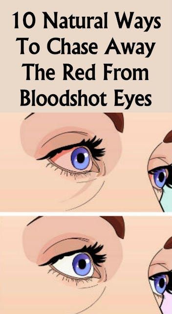 Red Eyes Remedy, Beginner Eyeshadow, Bloodshot Eyes, Lip Color Makeup, Body Organs, Tired Eyes, Cat Makeup, Lack Of Sleep, Chronic Fatigue