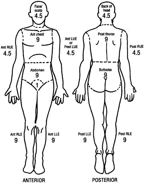 Rule of nines Rule Of Nines, Med Surg, Physician Assistant, Nursing Education, Nclex, Nurse Practitioner, Medical School, Nurse Life, Nursing School