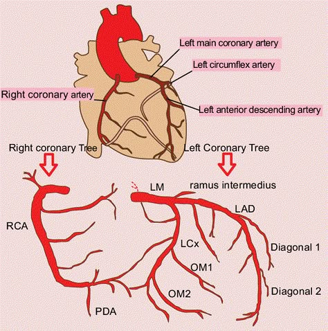 Right and left coronary trees. LAD: left anterior descending artery;... | Download Scientific Diagram Cath Lab Nursing, Arteries Anatomy, Cardiac Sonography, Cardiology Nursing, Coronary Artery, Nurse Study Notes, Nursing Mnemonics, Medical Student Study, Cardiac Nursing