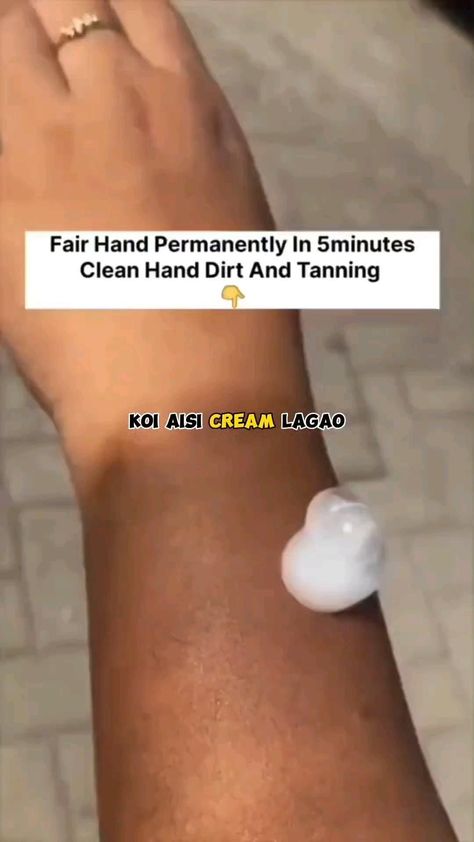 home remedies for removing tanning Tan Removal At Home, Closed Comedones, Skin Tan Removal, Skin Blackheads, Blackhead Remover Diy, Beginner Skin Care Routine, Home Remedies For Pimples, Face Skin Care Routine, Pimples On Face