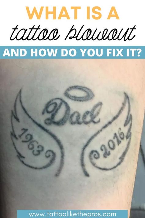 Blown Out Tattoo, Spot Work Tattoo, Blur Tattoos, Tattoo Fix Before And After, Fixing A Bad Tattoo, Tattoo Touch Up Before And After, Laser Tattoo Removal Process, Tattoo Touch Up, Tattoo Tips