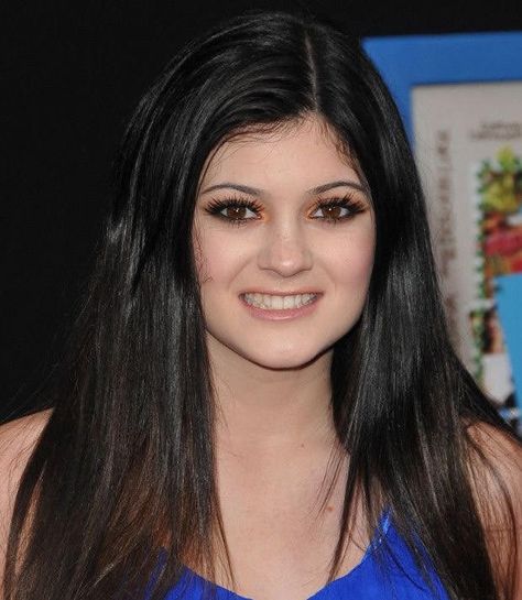 Kylie Jenner Plastic Surgery, Kylie Jenner Icons, Robert Kardashian Jr, Face Fillers, Kylie Jenner Look, Best Lip Gloss, Bruce Jenner, Robert Kardashian, Reconstructive Surgery