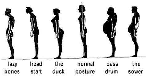 Sway Back Posture: A Common Postural Variation Bad Posture Reference, Posture Reference, Weights For Arms, Sway Back, Alexander Technique, Proper Posture, Bad Posture, Diastasis Recti, Body Awareness