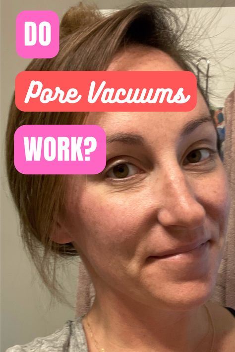 Pore Vacuum Videos, Pore Extraction, Pore Vacuum, Blackhead Extraction, Blackhead Vacuum, Vacuum Reviews, Blood Sugar Diet, Pore Cleanser, Natural Laundry