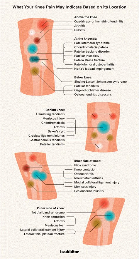 Knee Pain Exercises Physical Therapy, Physical Therapy For Knee Pain, Knee Exercises For Pain, Meniscus Pain Relief, Pain Behind The Knee, Back Of Knee Pain, Stretches For Knee Pain, Exercise For Knee Pain, Medial Knee Pain