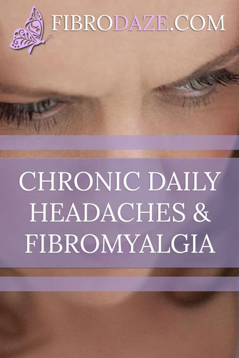 Chronic Daily Headaches & Fibromyalgia via @fibrodaze Chronic Headaches, Daily Headaches, Severe Migraine, Chronic Fatigue Symptoms, Headache Prevention, Chronic Migraines, Migraine Relief, Tension Headache, Headache Relief