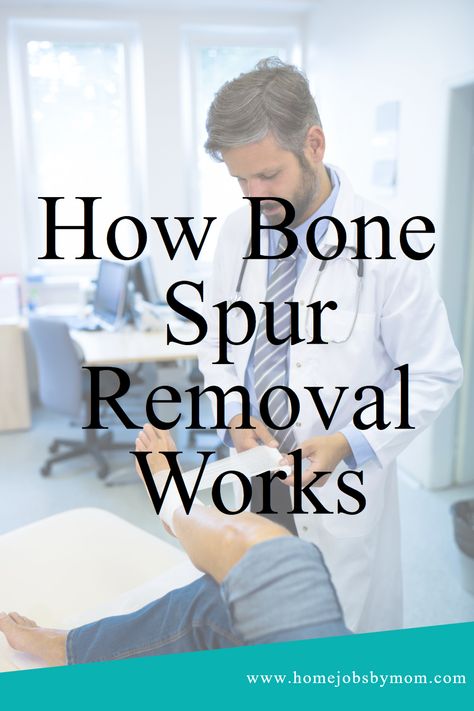 What's Bone Spur Removal? A technique to help reduce chronic pain & improve mobility. Find out more today! #BoneSpurRemoval #Surgery #Health Heal Spurs, Improve Mobility, Neck Bones, Physical Therapy Exercises, Body Hair Removal, Body Healing, Health Knowledge, Medical Conditions, Health Remedies