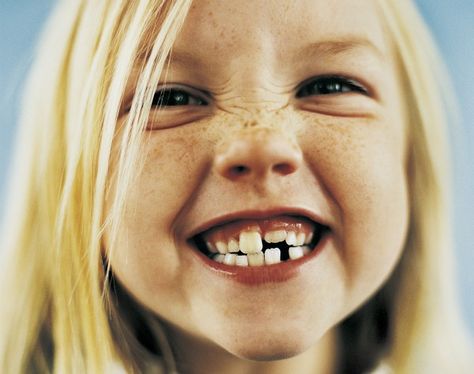 Birth Order, Kids Teeth, Missing Teeth, Pediatric Dentist, Pediatric Dentistry, Natural Teeth Whitening, Childrens Health, Baby Teeth, Healthy Teeth