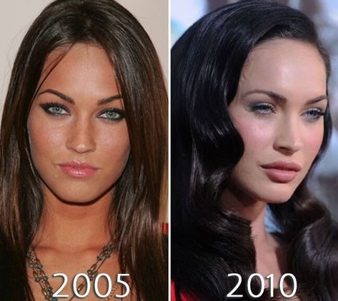 Megan Fox Lips Before And After, Megan Fox Lips, Fox White, Celebrity Plastic Surgery, Lip Fillers, Black White Dress, After Photos, Megan Fox, Famous Celebrities