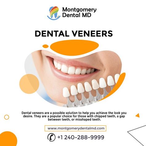 Dental Veneers are a possible solution to help you achieve the look you desire. They are a popular choice for those with chipped teeth, a gap between teeth, or misshaped teeth. . . Get in touch to book an appointment: 240-288-9999 or Visit: https://montgomerydentalmd.com/ . . #dental #Dentalcare #DentalOffice #dentistry #dentalassistant #tooth #dentist #oralhealth #Gaithersburg #MontgomeryVillage #invisalign #dentures #dentalfilling #dentalveneers Dental Veneers Creative Ads, Teeth Composite, Gap Between Teeth, Dental Meme, Medical Ads, Dental Post, Dental Advertising, Composite Veneers, Dental Images