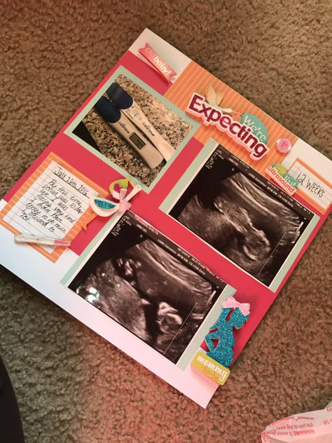 Scrapbook Ideas For Kids Memories, Ultrasound Scrapbook Ideas, Scrapbook Ideas For Baby, Babybook Scrapbook, First Year Scrapbook Ideas Baby, Newborn Scrapbook Ideas, Scrapbook Ideas Baby, Ultrasound Pictures Scrapbook, Baby Scrapbook Ideas Layout