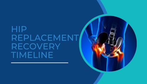 Hip Replacement Recovery Timeline, Hip Replacement Recovery, hip replacement recovery time Knee Health, Physical Therapy Exercises, Knee Replacement Surgery, Liquid Diet, Knee Replacement, Surgery Recovery, Post Surgery, After Surgery, Patient Experience