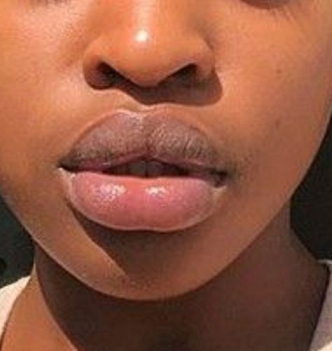 Big Pouty Lips, Two Toned Lips Natural, Lip Filler Black Women, 2 Toned Lips, Black Women Lips, Lips Claim, Desired Lips, Lip Reference, Black Reference