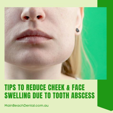 Does it feel like your face has doubled in size due to all the swelling that’s going on? That is a typical case happening to people suffering from tooth abscesses. It is usually accompanied by a bad salty taste in your mouth and throbbing pain whenever you chew. And the swelling starts to occur while you are asleep. #ToothAbscess #FacialSwelling #BadTasteInMouth #ThrobbingPain #AntibioticTreatment #DentistMainBeach #MainBeachDentalClinic Face Swelling Remedies, Abcessed Tooth Remedy Swelling, Reduce Swelling In Face, Absessed Tooth, Abcessed Tooth, Face Swelling, Swelling Remedies, Wisdom Teeth Swelling, Home Remedies For Face