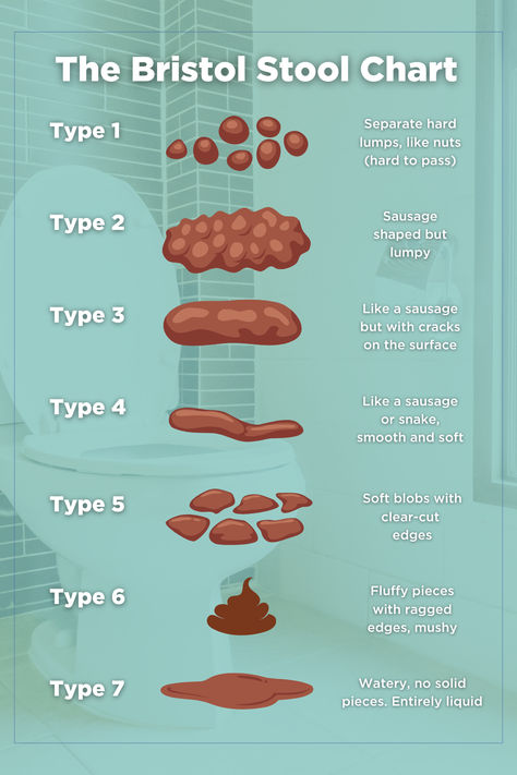 The Bristol Stool Chart is a medical tool that helps classify stool into seven categories based on their shape and consistency. It is used to help diagnose IBS. Find out more about gut health on our website: https://omedhealth.com/insights-hub/ Gut Healing Journey, Gut Motility, Heal Gut Lining, Stool Chart, Gut Health Infographic, Bristol Stool, Bristol Stool Chart, Improve Gut Motility, Health Conditions