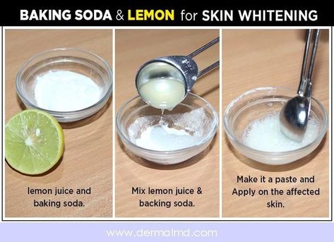 Benefits Of Baking Soda, Skin Lightening Diy, Baking Soda Face, Natural Skin Lightening, Baking Soda Benefits, Best Baking, Baking Soda And Lemon, Face Pack, Baking Soda Shampoo