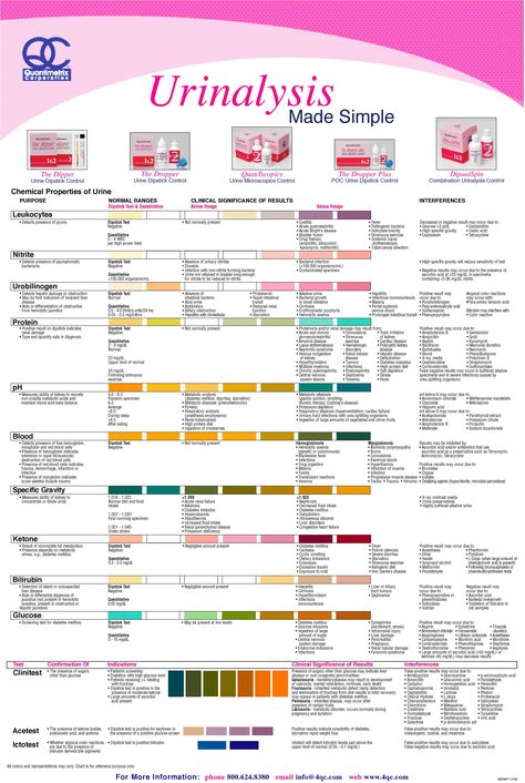 Urinalysis Dipstick Interpretation #Diagnosis #Urinalysis ... Urinalysis Results, Urine Analysis Cheat Sheet, Urinalysis Cheat Sheet, Urinalysis Interpretation, Memes Nursing, Phlebotomy Study, Medical Laboratory Science Student, Nursing Labs, Nursing Pictures