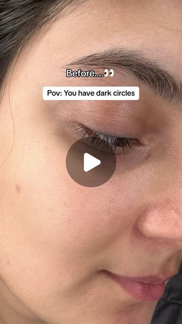 Homemade Dark Circle Eye Cream, Homemade Eye Mask For Dark Circles, How To Get Rid Of Dark Circles Under Eye, Coffee Eye Mask, Mask For Dark Circles, Homemade Eye Cream, Dark Circle Remedies, Coffee Mask, Soaked Almonds