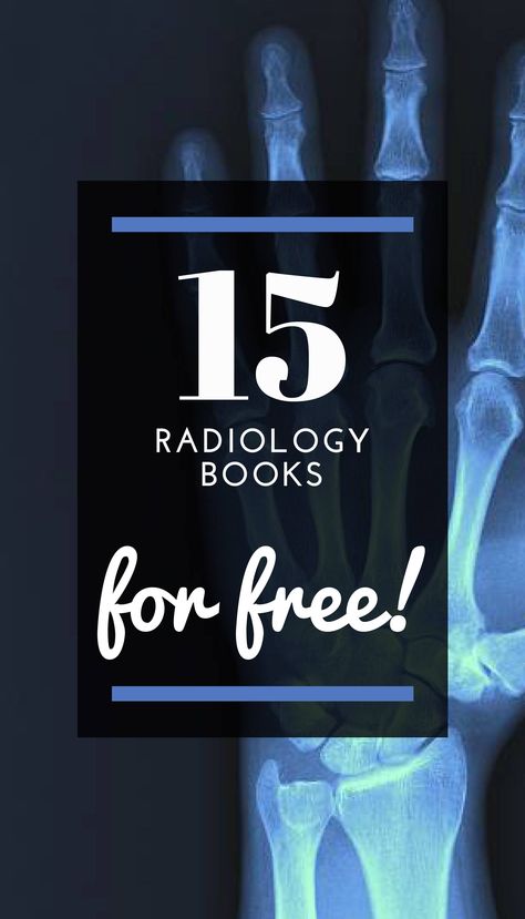 Looking for Radiology books to read for free? It's your lucky day! In this post we give you more than 15 books about Radiology that you can read completely free and download in PDF format! #infoboks #freebooks #pdfbooks #downloadbooks #Radiologybooks #Radiology Interventional Radiology Technologist, Radiology Student Must Haves, Interventional Radiology Nurse, Radiology Student Study Tips, Radiography Student Aesthetic, Radiology Student Study, Radiography Aesthetic, Radiology Physics, Radiology Student Aesthetic