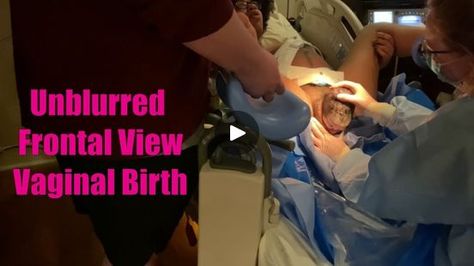 Giving Birth Videos Pushing Hospitals, Normal Delivery Videos Births, Baby Delivery Videos, Giving Birth Videos Pushing, Natural Birth Videos Pushing, People Giving Birth Videos, Water Birth Video, Birth Videos, Raw Pictures