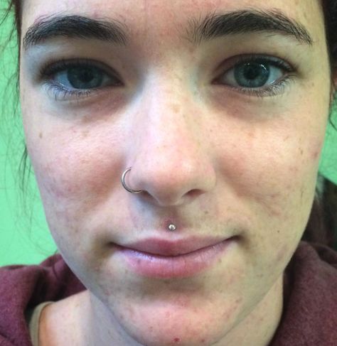 Tiny Medusa Piercing, Small Medusa Piercing, Medusa Piercing Aesthetic, Dolphin Bites, Girls With Nose Rings, Dream Piercings, Medusa Piercing Jewelry, Philtrum Piercing, Lip Piercings