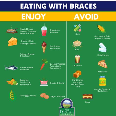 Good Foods To Eat With Braces, Soft Foods To Eat After Getting Braces, Braces Diet Soft Foods, Braces Safe Snacks, What Can I Eat With Braces, Braces Foods To Eat, What To Eat When You Have Braces, Good To Eat With Braces, Foods To Eat With Braces Meals